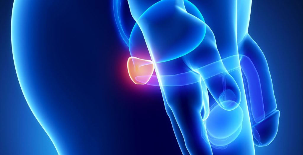 Питание при хроническом простатите: 13 запрещенных продуктов